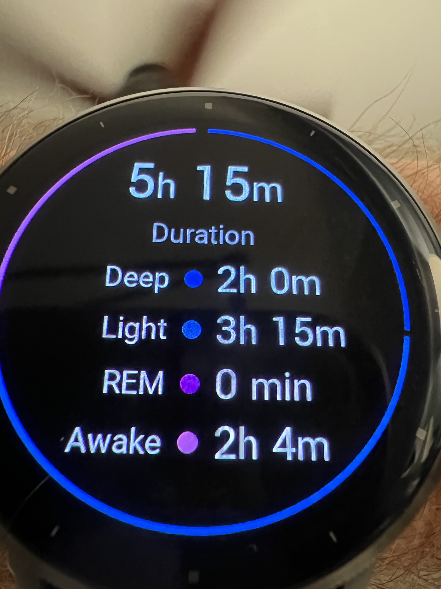 how to reduce systemic inflammation
